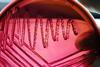 E. coli on emb agar